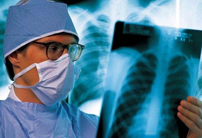 Эффективно ли Покров противостоит туберкулезу и ВИЧ?