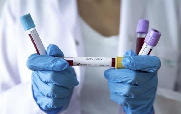 У Покрові ще один лабораторно підтверджений випадок коронавірусу