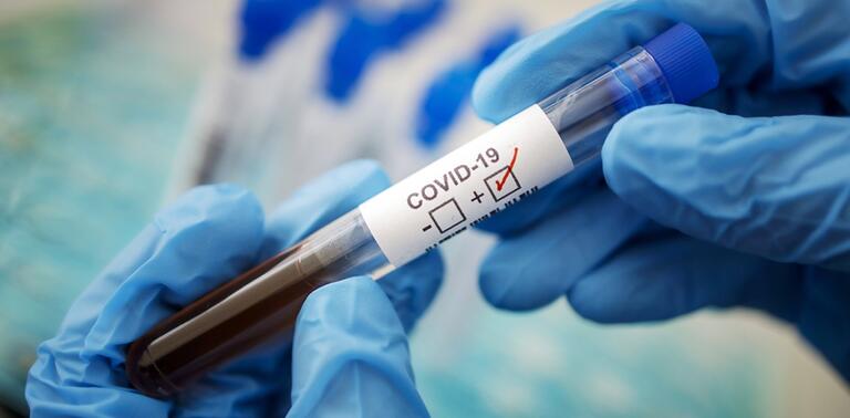 На Дніпропетровщині рівень захворюваності на COVID-19 знизився на 75%