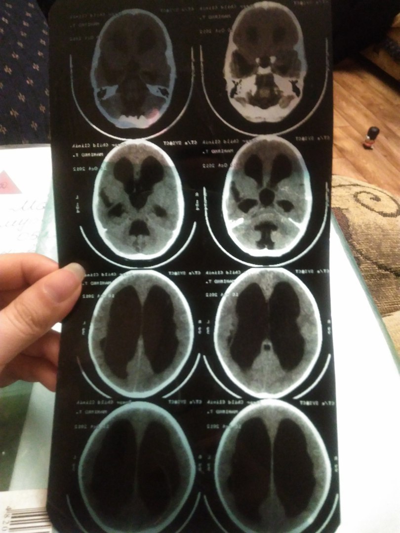 прошу помочь спасти ребёнку жизнь!!! - изображение 2