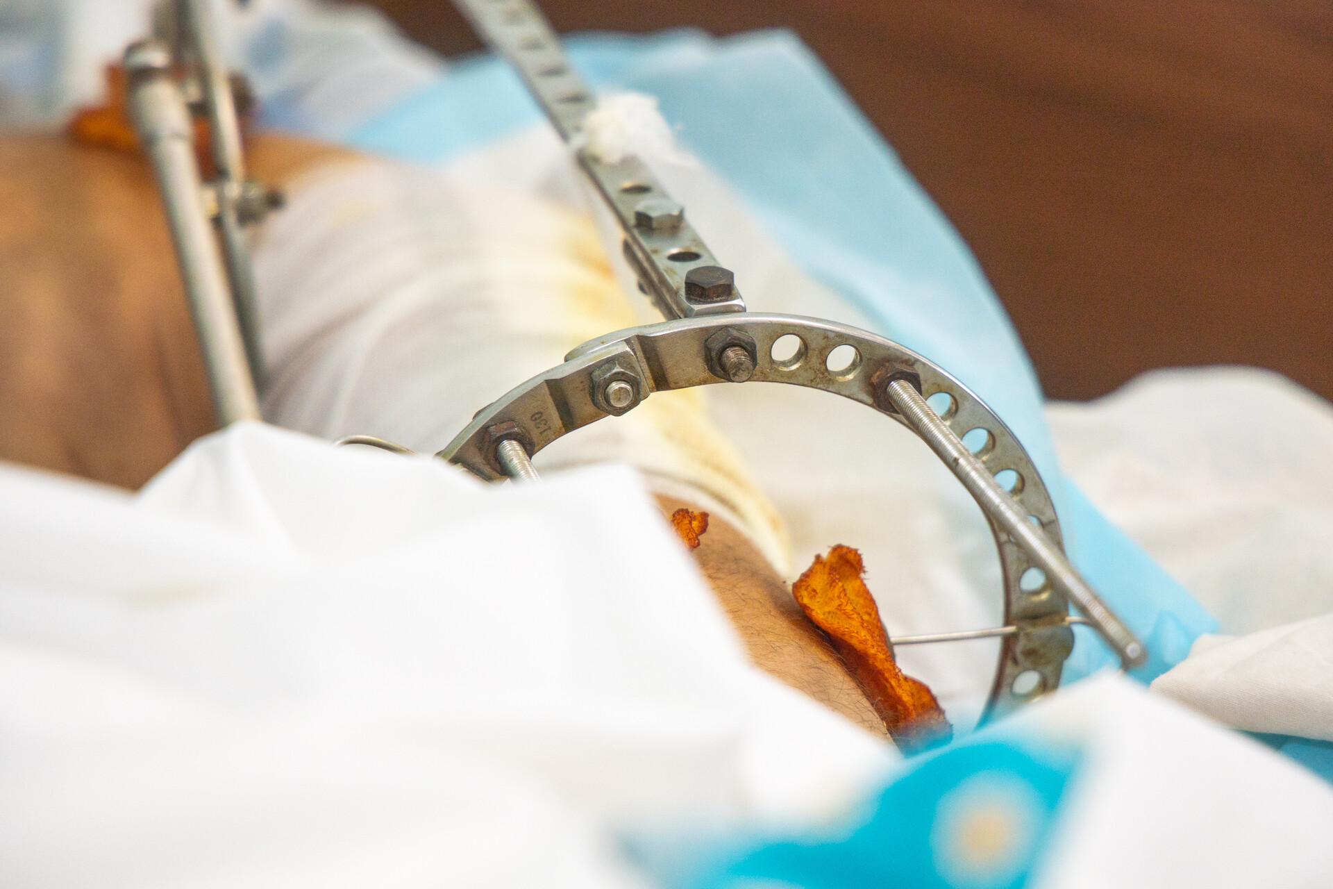 з лікарень дніпропетровщини виписали 42 людини, які постраждали від ворожої атаки на вокзалі краматорська - зображення 2 з лікарень дніпропетровщини виписали 42 людини, які постраждали від ворожої атаки на вокзалі краматорська - зображення 2