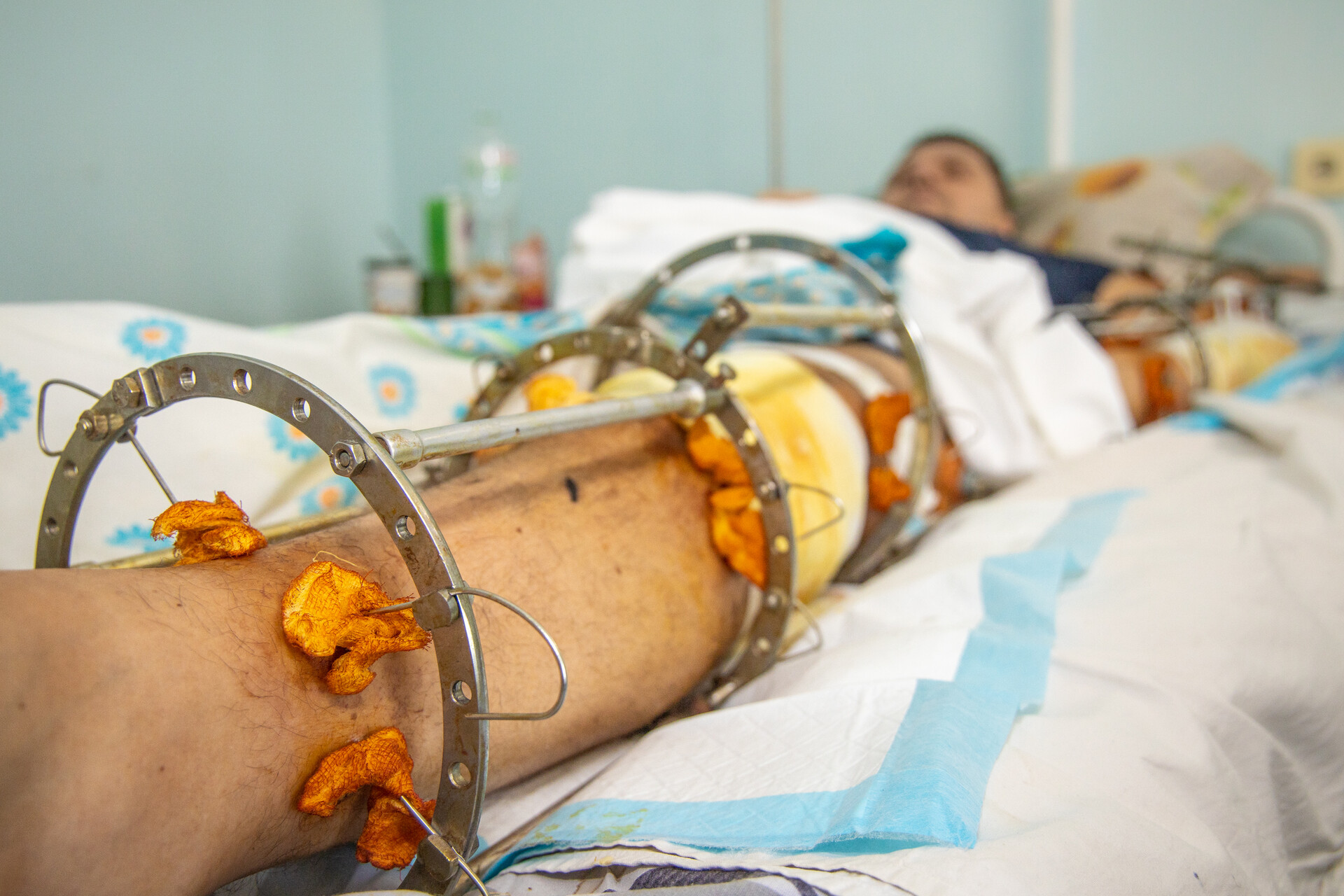 з лікарень дніпропетровщини виписали 42 людини, які постраждали від ворожої атаки на вокзалі краматорська - зображення 3 з лікарень дніпропетровщини виписали 42 людини, які постраждали від ворожої атаки на вокзалі краматорська - зображення 3