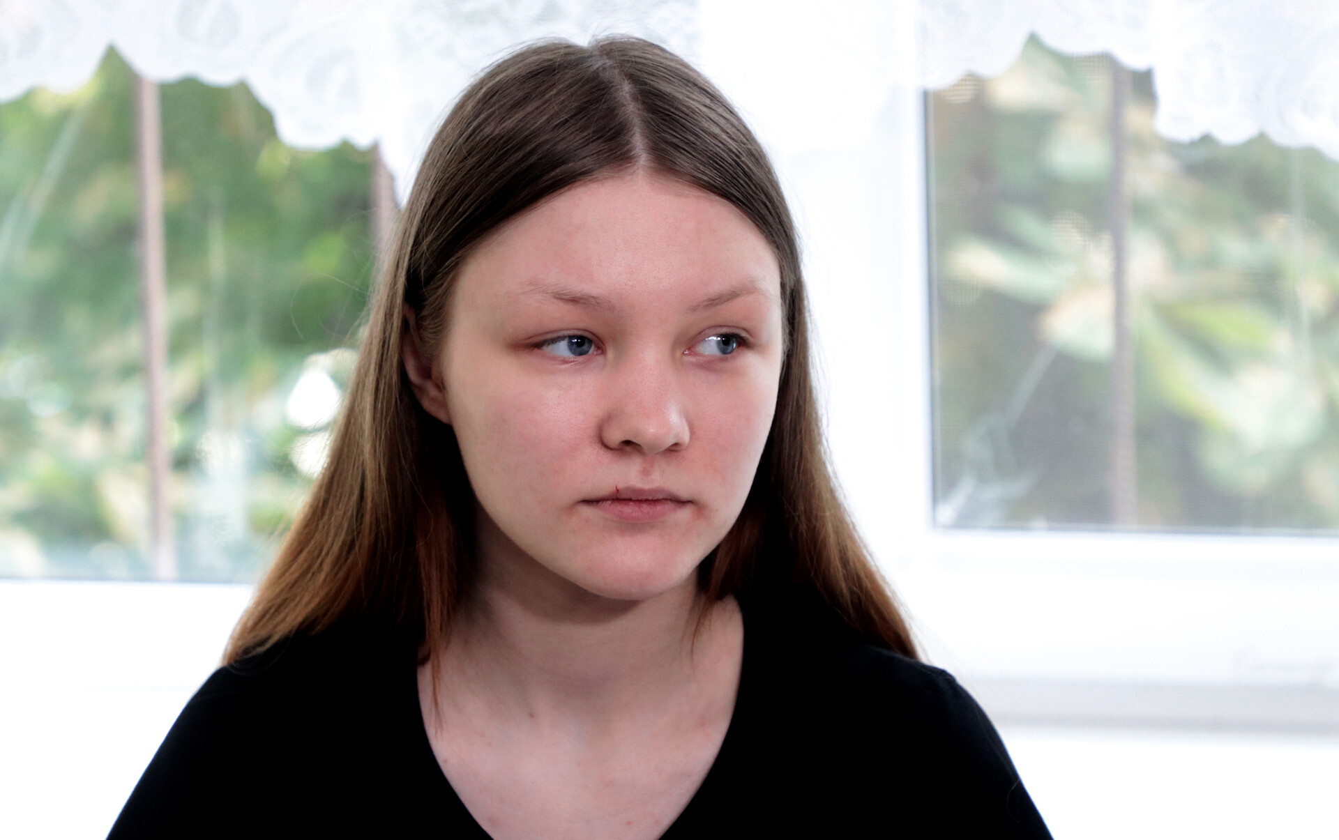 ледь залишились живими: постраждала з нікополя розповіла про обстріли своєї домівки - изображение 1